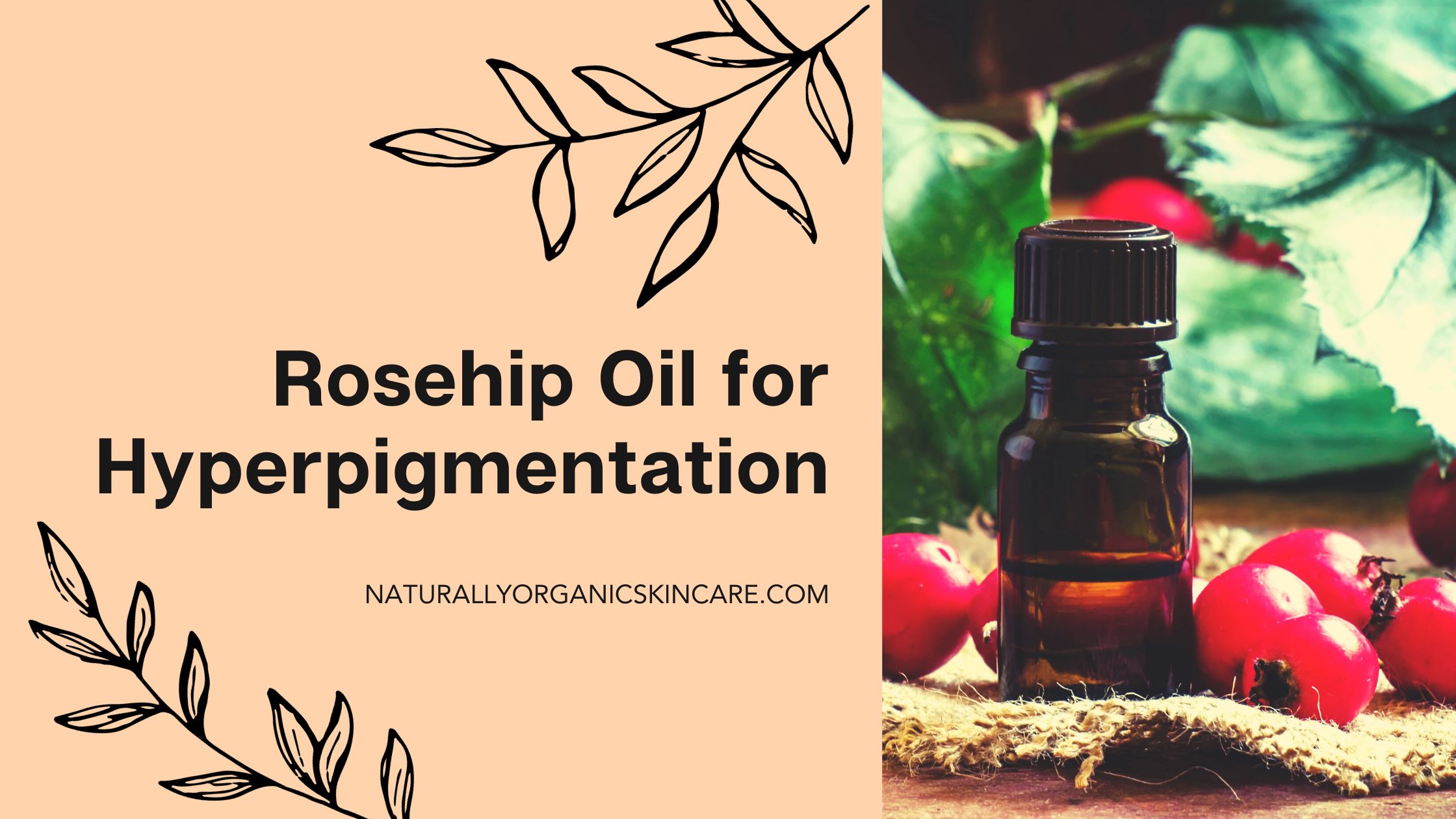 rosehip oil for hyperpigmentation